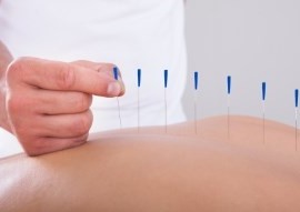 China Health: Acupunture to treat fertility
